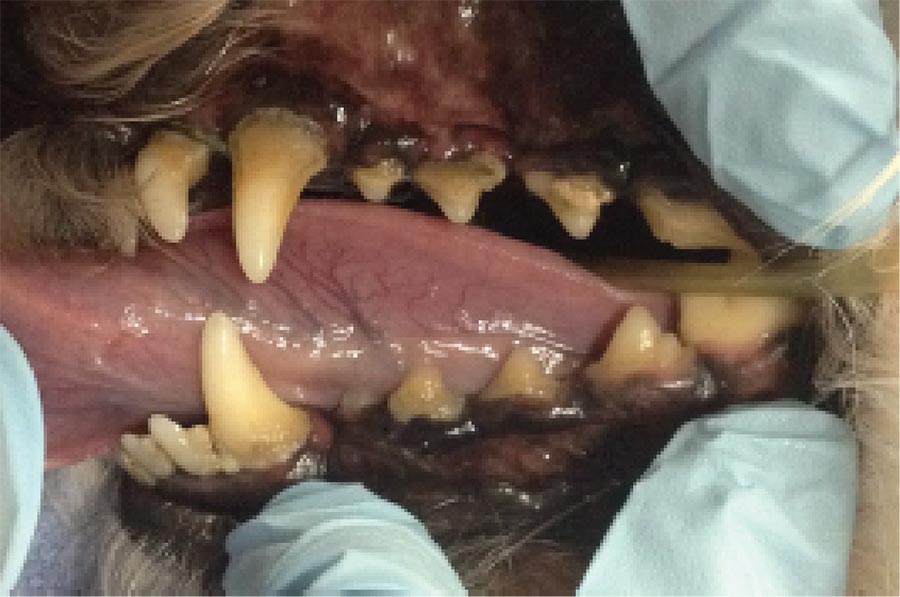 Before Dental Prophylaxis